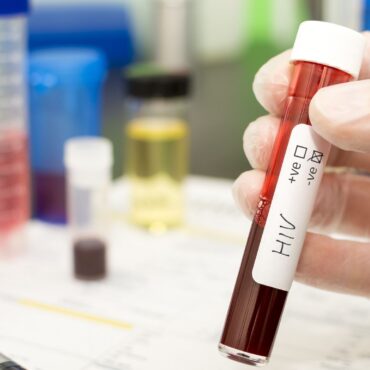 HIV deaths and infections will rise as a result of foreign aid cuts, study warns