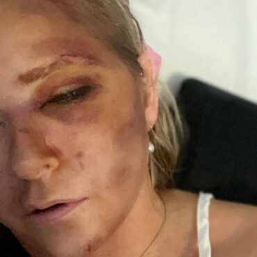Prince Andrew accuser says she has days to live after car crash