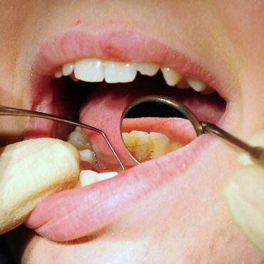 Scheme to boost access to NHS dentists has made things worse, MPs say
