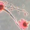 Killer fungus forecast to spread to UK