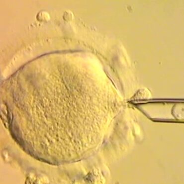 Babies born in UK with DNA from three people to treat inherited disease takes medicine into uncharted territory
