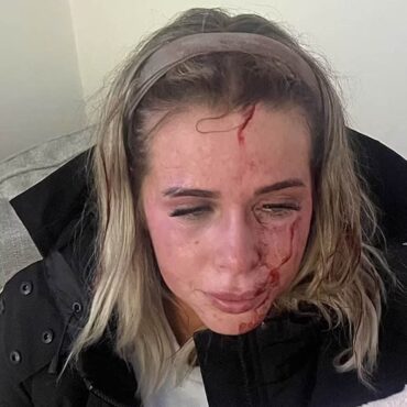Grooming victim ‘lives with trauma every day’ – as force investigates crimes involving more than 700 survivors