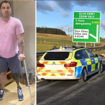Man who had leg amputated after hit-and-run describes ‘agony’ of ‘phantom pain’