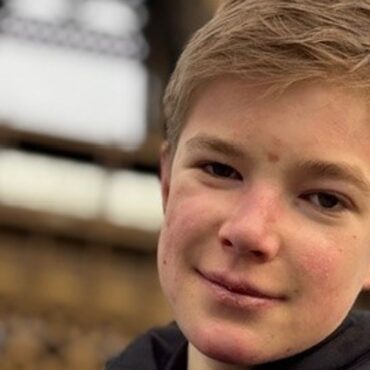 Boy with painful skin condition given hope after taking part in trial for first potential treatment