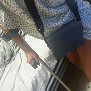 Woman told she may have to lose leg to stay alive after liquid Brazilian butt lift