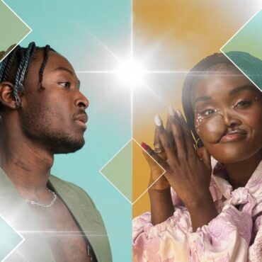 What if Romeo had a scar? Or Juliet a facial difference? The actors challenging screen conventions