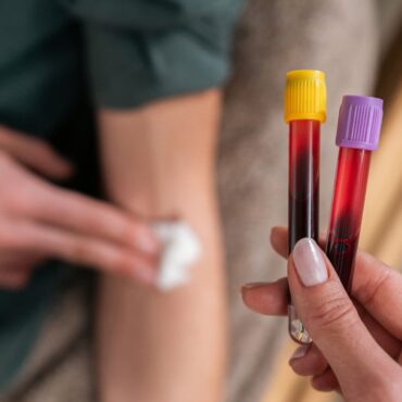 New blood test for more than 50 cancers ‘could transform outcomes’