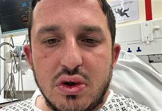 Pub attacker admits injuring teacher with hand sanitiser