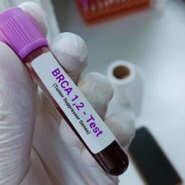 Why prostate cancer is expected to be left as the only major cancer without national screening