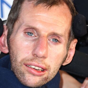 Drug breakthrough could ‘substantially slow progression’ of motor neurone disease