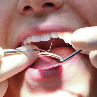 Dentists to be paid more to see urgent patients