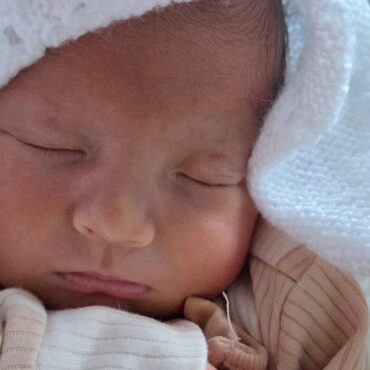 How newborns with jaundice can receive vital treatment at home