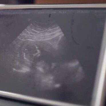 Woman says she ‘begged for pain relief but was told no’ – amid national call for birth stories