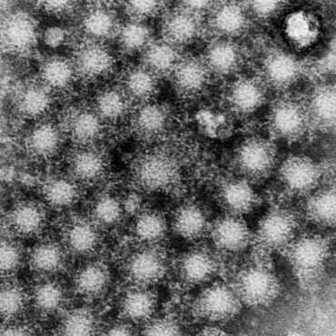 Parents told to check children’s handwashing after hepatitis A outbreak