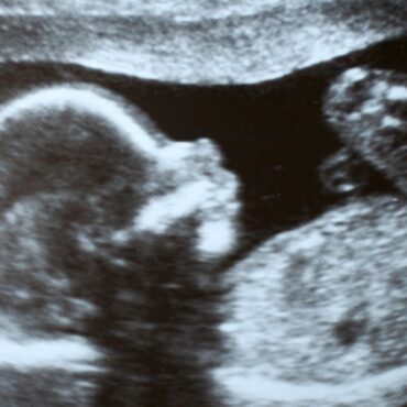 Inside UK’s maternity crisis: What it’s really like to give birth