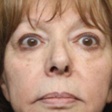 Woman who stabbed husband with vegetable knife jailed