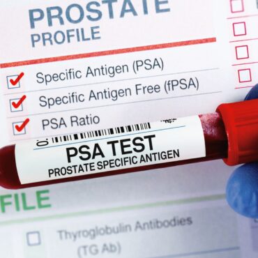 Prostate cancer cases surge in UK – as charity warns against ‘myths’