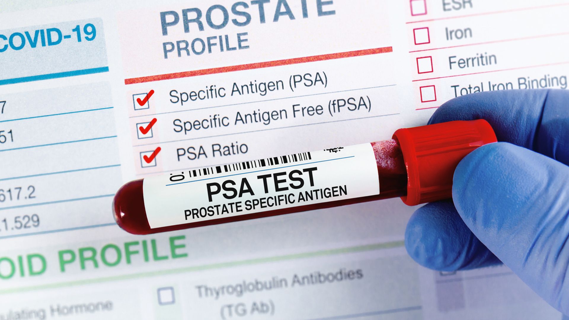 Prostate cancer cases surge in UK – as charity warns against ‘myths’