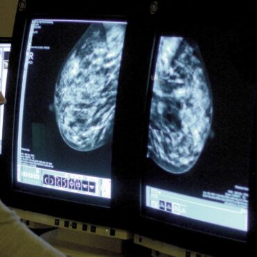 Women under 50 at risk of breast cancer are not being referred – study