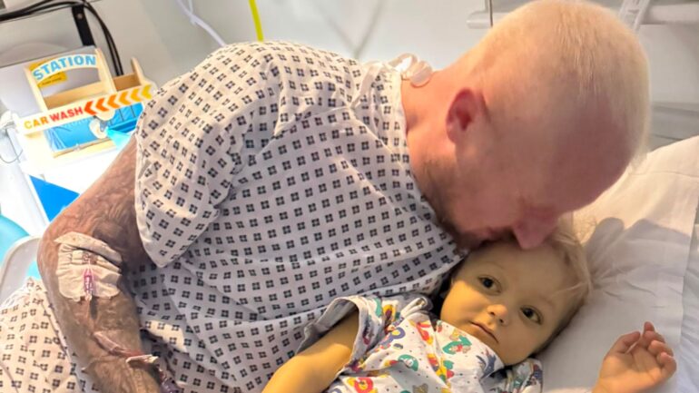 Man donates part of liver and bowel to save son