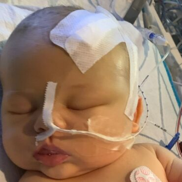 Newborn baby’s nail infection led to brain tumour diagnosis