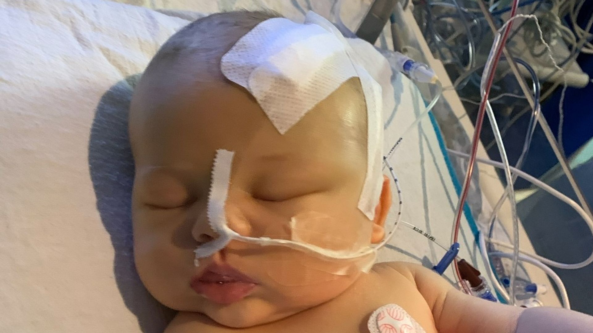 Newborn baby’s nail infection led to brain tumour diagnosis